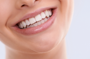 Citrulinación mediada por patógenos periodontales e impacto en la salud bucodental y sistémica