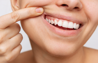 El papel mediador de la inflamación sistémica en la asociación entre la periodontitis y la diabetes gestacional