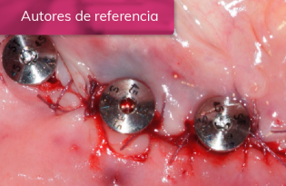 Prótesis híbrida inferior