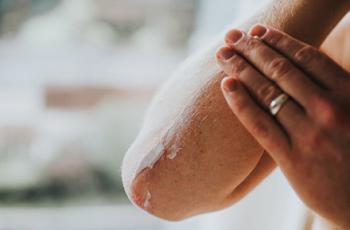 Psoriasis y periodontitis