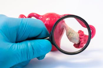 Periodontitis y síndrome de ovario poliquístico.