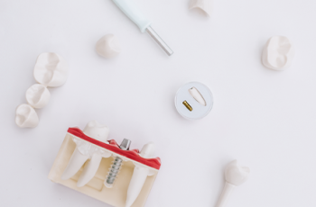 Regeneration vs extraction