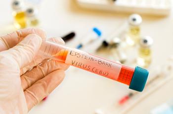 Virus de Epstein-Barr: ¿puede causar periodontitis?