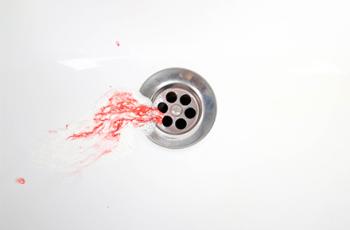 Gingival bleeding on brushing as a sentinel sign of gingival inflammation:...