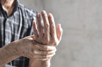 Asociación entre la periodontitis y la osteoartritis 