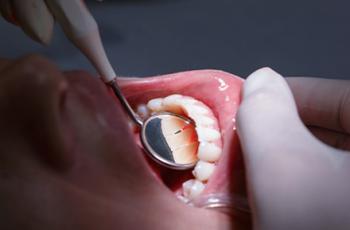 The association between chronic periodontitis and oral Helicobacter...