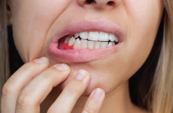 Combinación de biomarcadores moleculares en fluidos orales para el...
