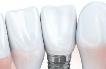 Enfermedades periimplantarias