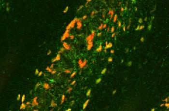 Ponencia  “Microbiología de la periimplantitis”