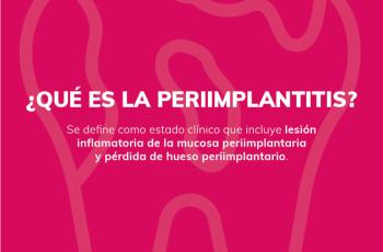 ¿Qué es la periimplantitis?