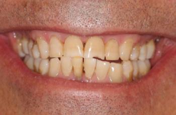 Aplicación de técnicas regenerativas y reconstructivas para la...