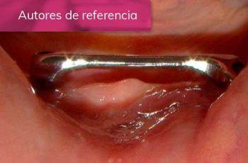 TRATAMIENTO DE PACIENTE CON MUCOSITIS PERIIMPLANTAR Y CELULITIS FACIAL
