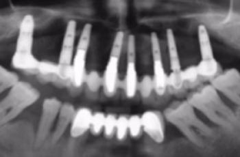 Importancia del mantenimiento en la evolución de un paciente con...