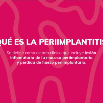¿Qué es la periimplantitis?
