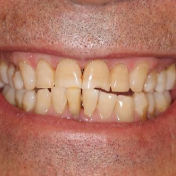 Aplicación de técnicas regenerativas...