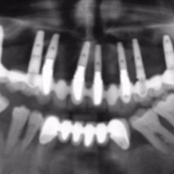 Importancia del mantenimiento en la...