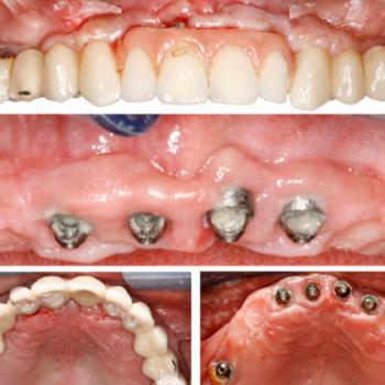 Etiología, diagnóstico y...