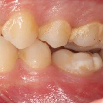 Aplicación clínica de la tecnología...