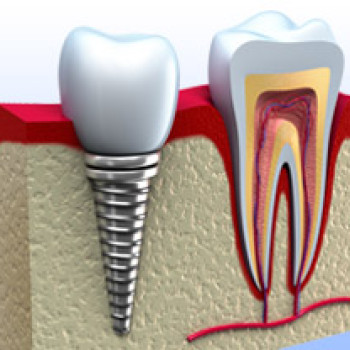 Prevalencia, Diagnóstico y Tratamiento...