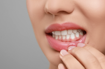 Spring Cleaning for Your Health: Start with Your Gums