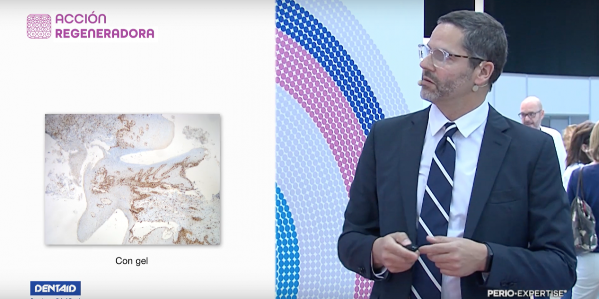 VIDEO: Dr. Xavier Calvo sobre el estudio clínico de las acciones principales de Perio·Aid Gel Bioadhesivo.
