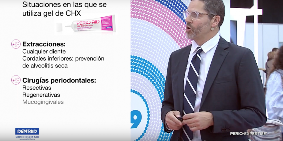VIDEO: Dr. Xavier Calvo sobre las situaciones en las que podemos usar Perio·Aid Gel Bioadhesivo en la clínica dental.