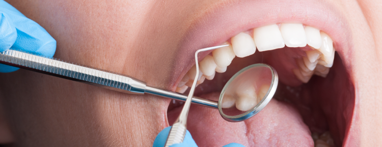 Asociación entre el índice Life’s Essential 8 y la periodontitis en adultos estadounidenses