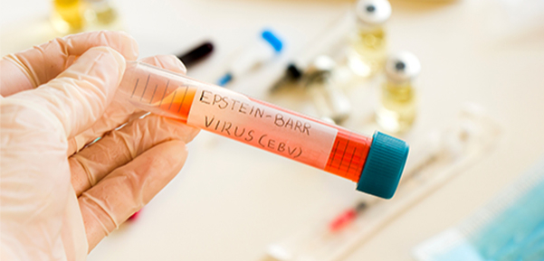 Virus de Epstein-Barr: ¿puede causar periodontitis?
