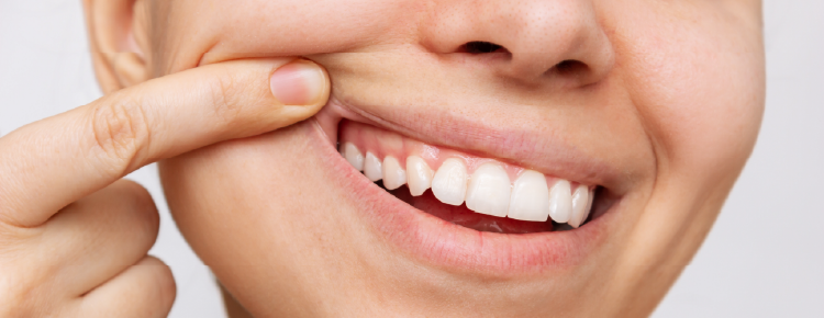 El papel mediador de la inflamación sistémica en la asociación entre la periodontitis y la diabetes gestacional