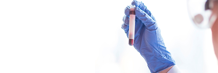 Anemia y enfermedad periodontal