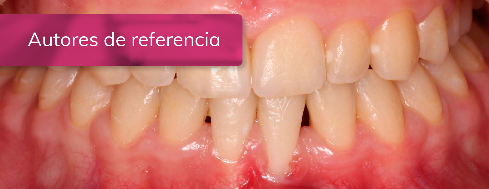 TRATAMIENTO DE GINGIVITIS INDUCIDA POR BIOFILM DENTAL